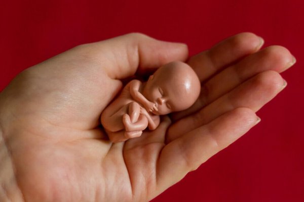 Cinsiyet belli olduktan sonra kürtaj yapılır mı?
