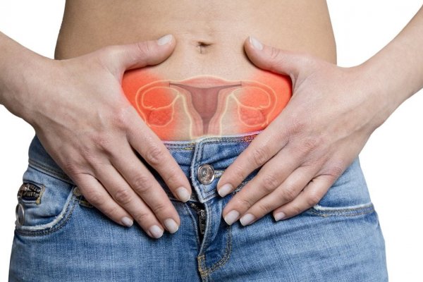 Çikolata Kisti Nedir?